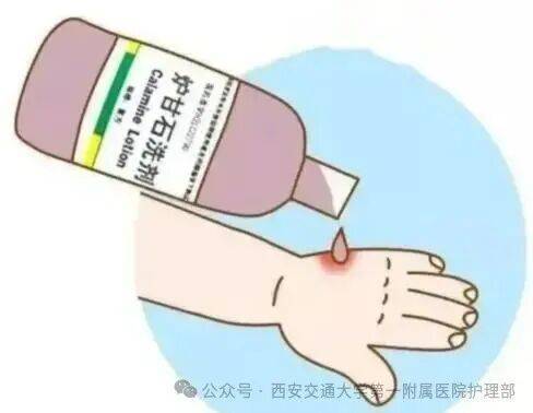 西安多区发现隐翅虫?千万别拍!毒液堪比硫酸